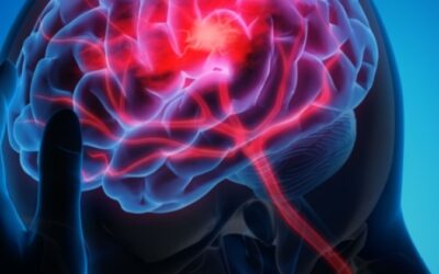 Fast junaci- prepoznaj moždani udar na vrijeme